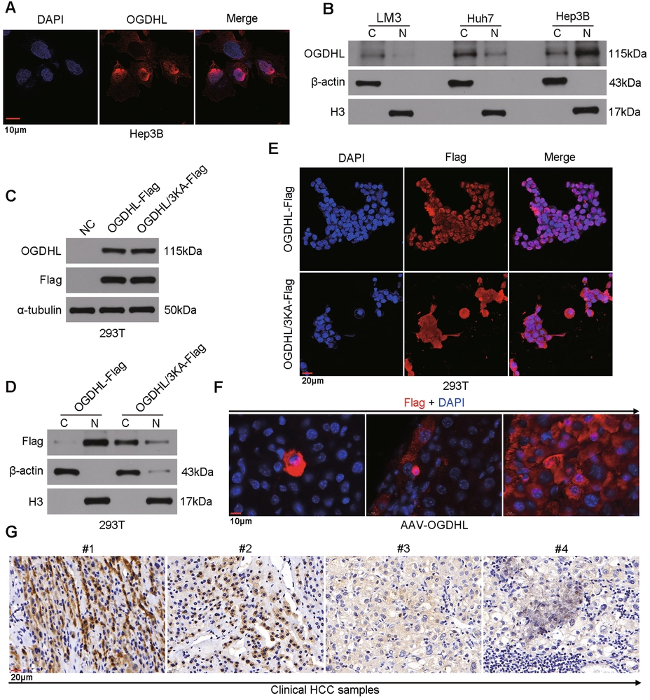 Oxoglutarate dehydrogenase-like inhibits the progression of hepatocellular carcinoma by inducing DNA damage through non-canonical function