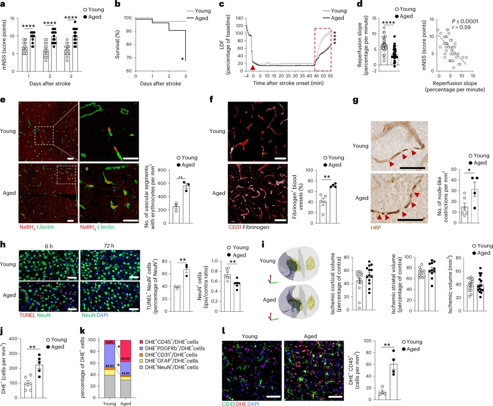 Age-induced alterations of granulopoiesis generate atypical neutrophils that aggravate stroke pathology