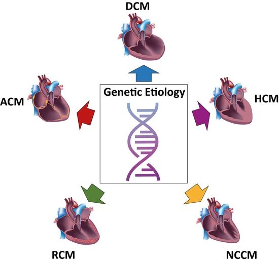 IJMS, Vol. 20, Pages 4381: Human Induced Pluripotent Stem-Cell-Derived Cardiomyocytes as Models for Genetic Cardiomyopathies