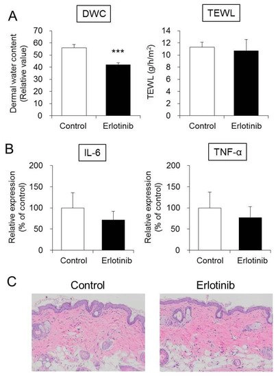 Epidermal Growth Factor Receptor Tyrosine Kinase Inhibitor Erlotinib Induces Dry Skin Via Decreased In Aquaporin 3 Expression Researcher An App For Academics