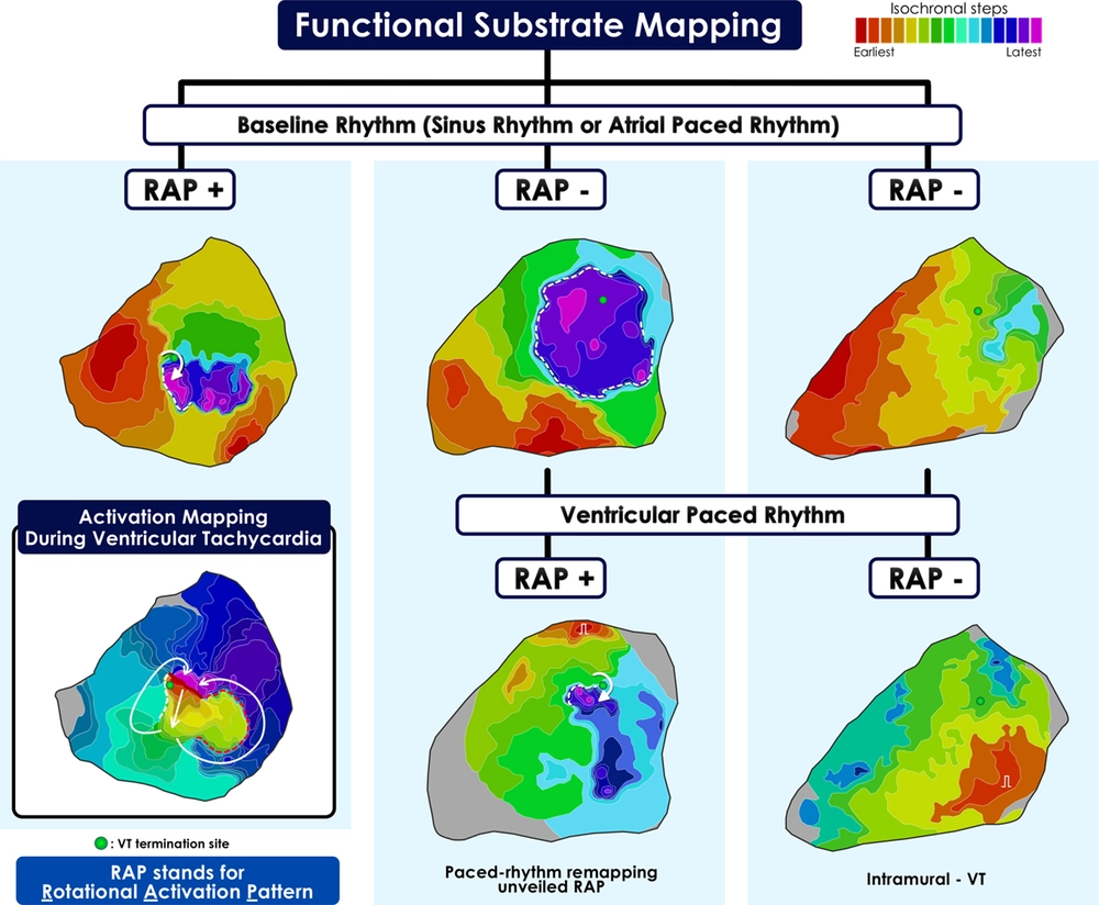 Rotational Activation Pattern During Functional Substrate Mapping N